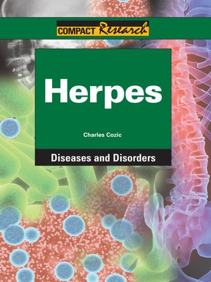 cover image of Herpes